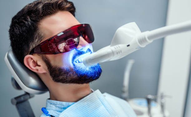 Laser Teeth Whitening